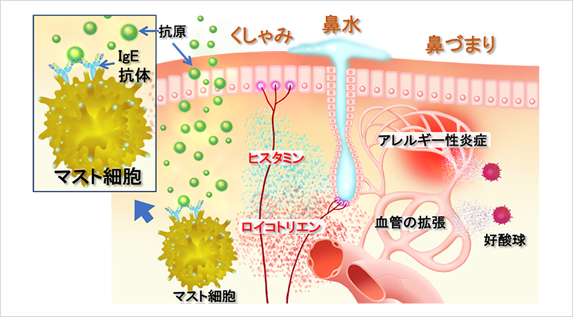 【図1】IgE抗体やマスト細胞によるアレルギー反応