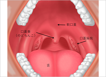 【図2】口腔内のイラスト
