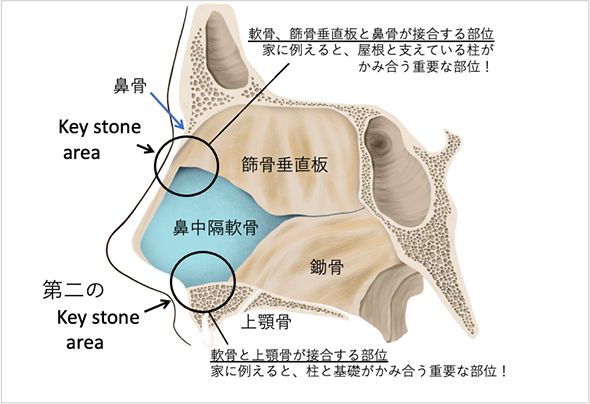 【図5】鼻中隔のkey stone area