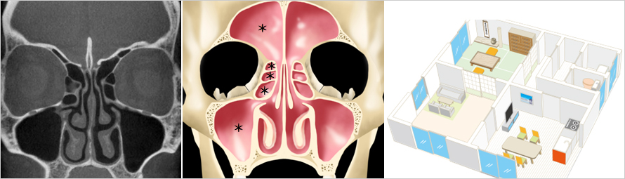 【図1】副鼻腔の構造